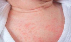 CẨM NANG “NHÌN DA SỬ DỤNG BỘT TẮM NHÂN HƯNG ĐÚNG CÁCH”