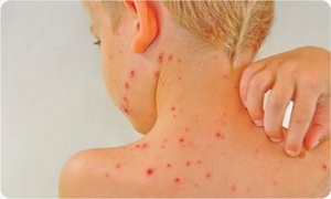 CẨM NANG “NHÌN DA SỬ DỤNG BỘT TẮM NHÂN HƯNG ĐÚNG CÁCH”