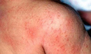 CẨM NANG “NHÌN DA SỬ DỤNG BỘT TẮM NHÂN HƯNG ĐÚNG CÁCH”