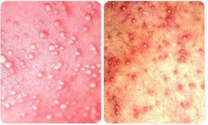 CẨM NANG “NHÌN DA SỬ DỤNG BỘT TẮM NHÂN HƯNG ĐÚNG CÁCH”