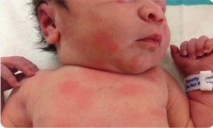 CẨM NANG “NHÌN DA SỬ DỤNG BỘT TẮM NHÂN HƯNG ĐÚNG CÁCH”