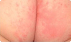 CẨM NANG “NHÌN DA SỬ DỤNG BỘT TẮM NHÂN HƯNG ĐÚNG CÁCH”