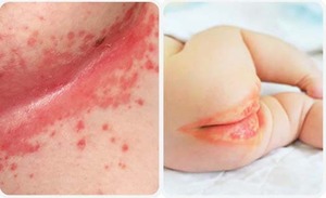 CẨM NANG “NHÌN DA SỬ DỤNG BỘT TẮM NHÂN HƯNG ĐÚNG CÁCH”