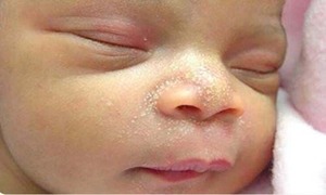 CẨM NANG “NHÌN DA SỬ DỤNG BỘT TẮM NHÂN HƯNG ĐÚNG CÁCH”
