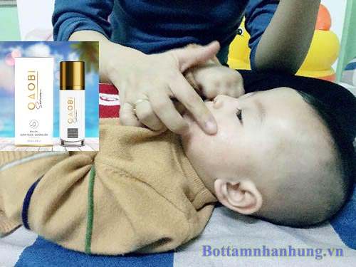 Thoa lên vùng da chàm sữa của trẻ