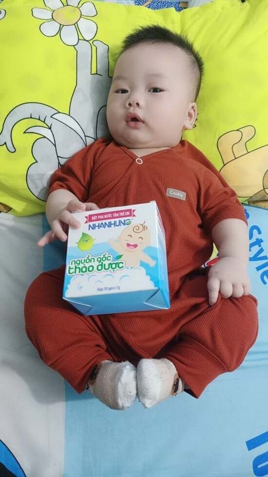 Bột tắm Nhân Hưng giúp trị mẩn ngứa ở trẻ an toàn, hiệu quả