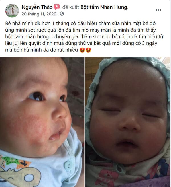 Hàng loạt mẹ bỉm “khoe” thành tích trị chàm sữa cho con “bất bại”