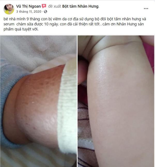 Link mẹ chia sẻ: https://www.facebook.com/ngoan.vu.3192/posts/1301786313490160