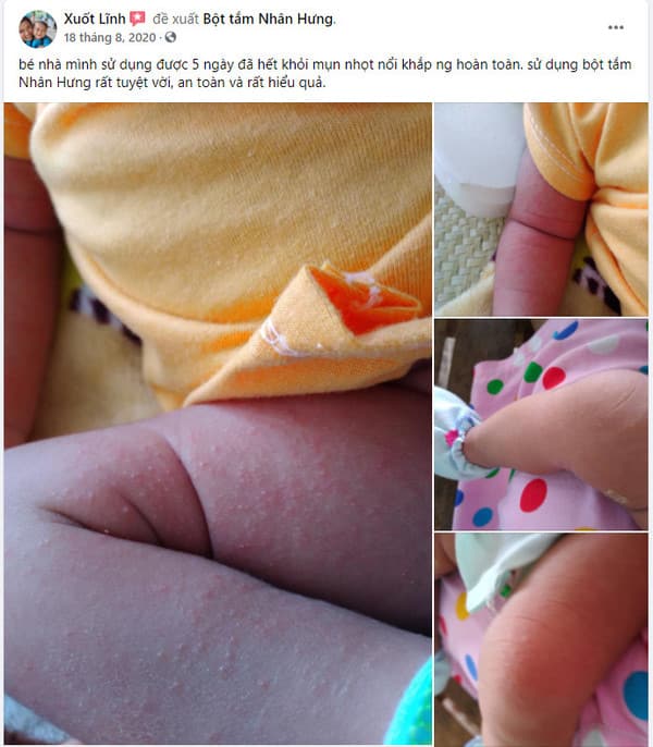 Link mẹ chia sẻ: https://www.facebook.com/linh.xuot.5/posts/327951305021581