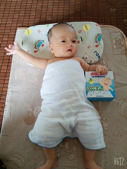 1 tháng 20 ngày bé Bảo Châu đã mắc rôm sảy