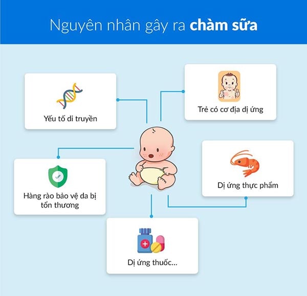 Nguyên nhân chính gây ra bệnh chàm sữa ở trẻ.