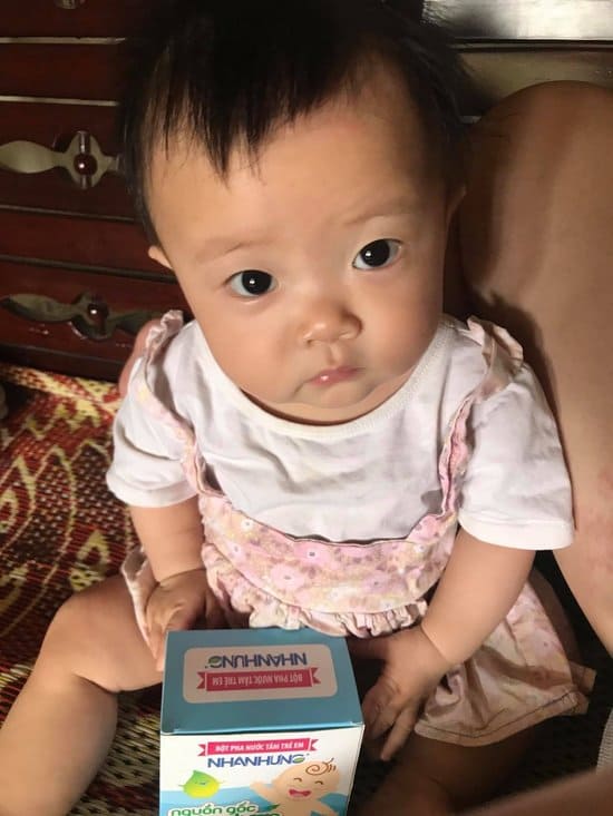 Quỹ chăm sóc da bé Nhân Hưng giúp hàng triệu trẻ em Việt thoát khỏi bệnh ngoài da