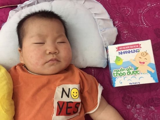 Quỹ chăm sóc da bé Nhân Hưng giúp hàng triệu trẻ em Việt thoát khỏi bệnh ngoài da