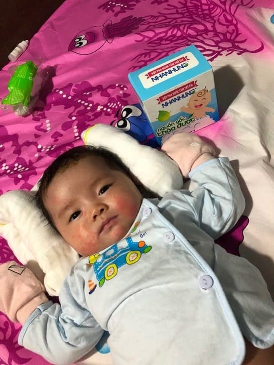 Quỹ chăm sóc da bé Nhân Hưng giúp hàng triệu trẻ em Việt thoát khỏi bệnh ngoài da