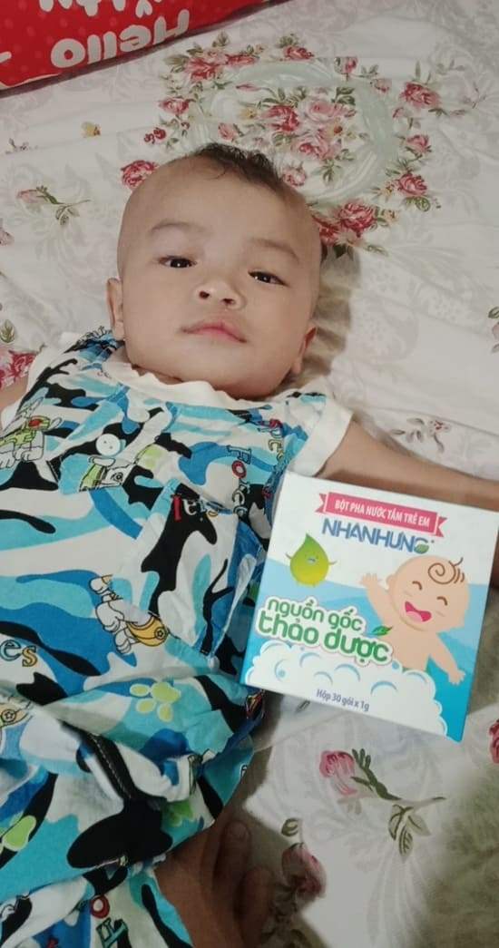 Quỹ chăm sóc da bé Nhân Hưng giúp hàng triệu trẻ em Việt thoát khỏi bệnh ngoài da