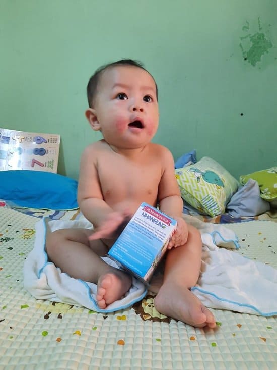 Quỹ chăm sóc da bé Nhân Hưng giúp hàng triệu trẻ em Việt thoát khỏi bệnh ngoài da