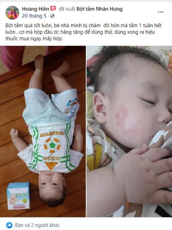Review trước và sau khi dùng Bột tắm Nhân Hưng: Đọc ngay kẻo lỡ!!!