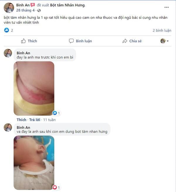 Review trước và sau khi dùng Bột tắm Nhân Hưng: Đọc ngay kẻo lỡ!!!