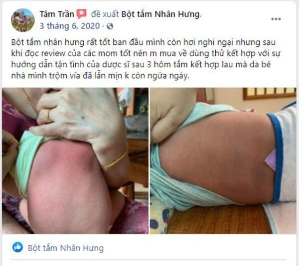 Review trước và sau khi dùng Bột tắm Nhân Hưng: Đọc ngay kẻo lỡ!!!