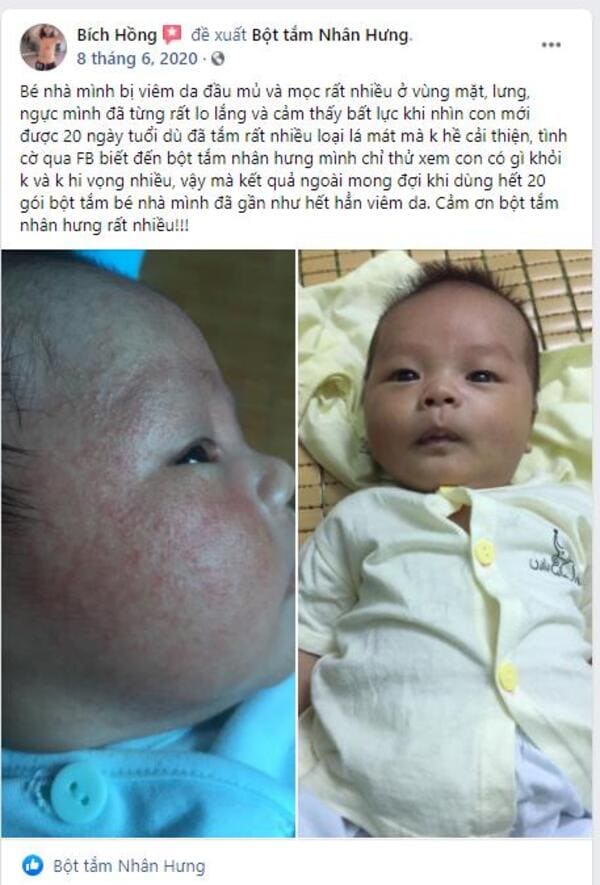 Review trước và sau khi dùng Bột tắm Nhân Hưng: Đọc ngay kẻo lỡ!!!