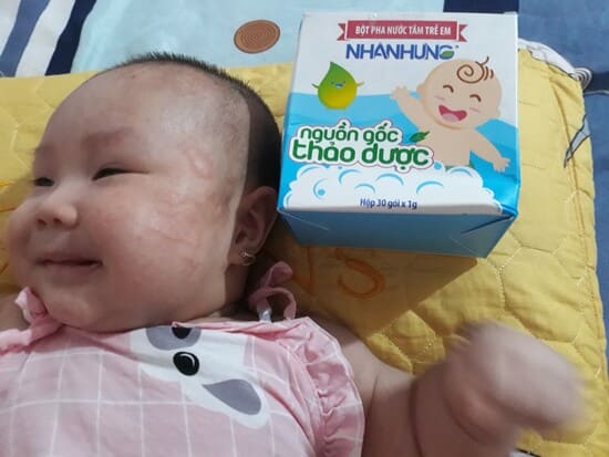 TỔNG KẾT THÁNG 5: 100 HỘP BỘT TẮM NHÂN HƯNG MIỄN PHÍ ĐÃ CÓ CHỦ