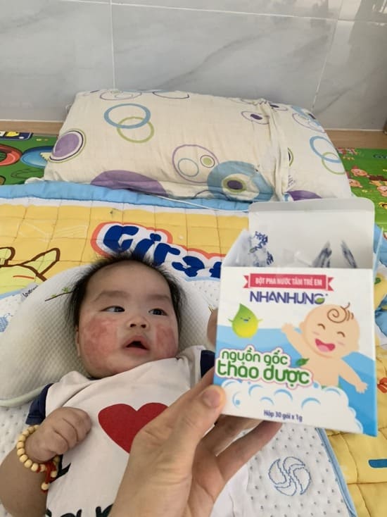 TỔNG KẾT THÁNG 5: 100 HỘP BỘT TẮM NHÂN HƯNG MIỄN PHÍ ĐÃ CÓ CHỦ