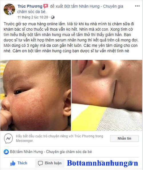 Hiệu quả của bộ đôi chàm sữa Nhân Hưng được các mẹ bỉm sữa kiểm chứng