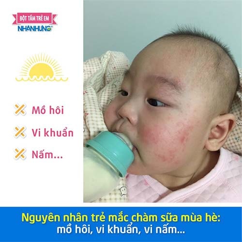 Trong mồ hôi có chứa nhiều acid, là điều kiện để vi khuẩn tấn công da trẻ.