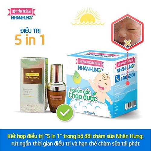 Kết hợp điều trị chàm sữa “5 in 1” trong bộ đôi chàm sữa Nhân Hưng.