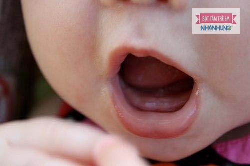 Bé 1 tuổi biếng ăn có thể do việc mọc răng