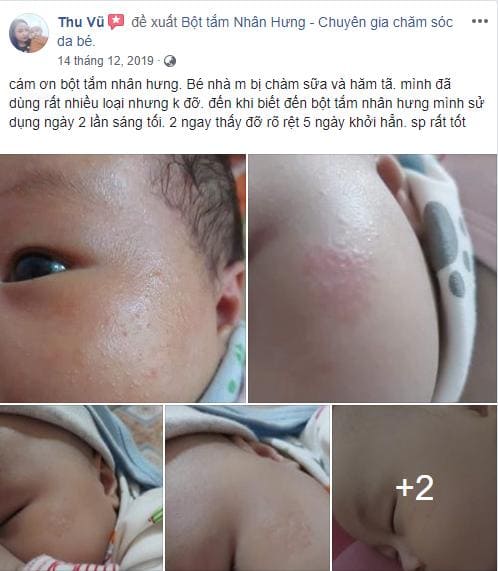 Chỉ sau 5 ngày dùng Bộ đôi loại bỏ chàm sữa Nhân Hưng, mẹ Thu ngạc nhiên vì bệnh chàm sữa ở con đã khỏi hẳn