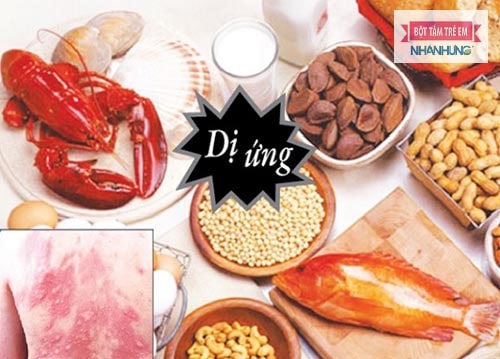 Không sử dụng thực phẩm dễ gây dị ứng khi bé bị chàm sữa