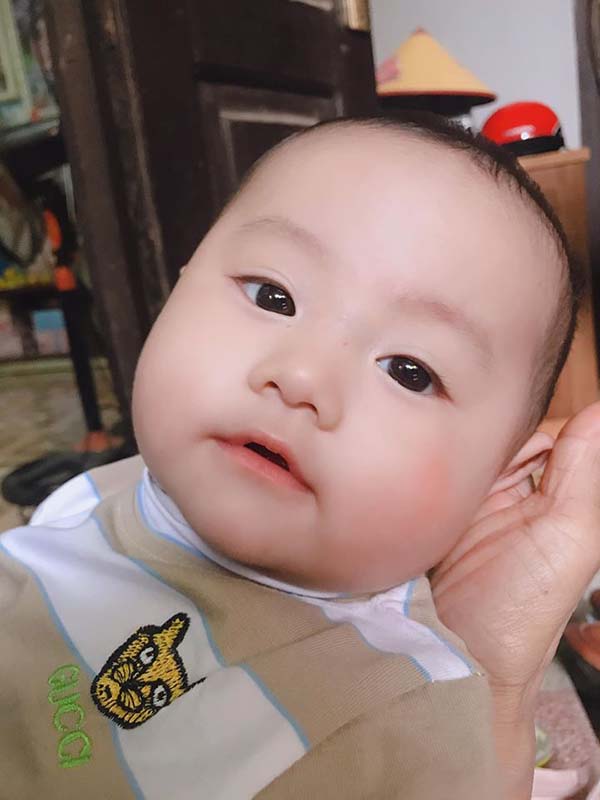 Nhờ Bột tắm Nhân Hưng mà da mặt bé Bo đã trở lại mịn màng, khỏe mạnh