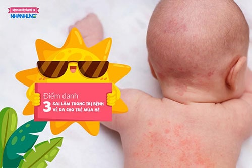 Điểm danh 3 sai lầm trong trị bệnh về da cho trẻ mùa hè
