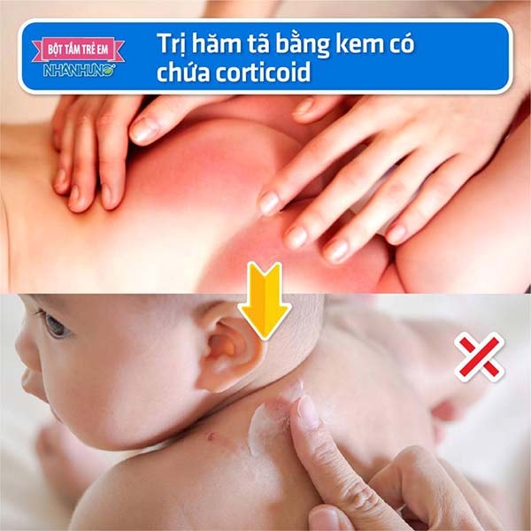 Lạm dụng kem bôi có chứa corticoid