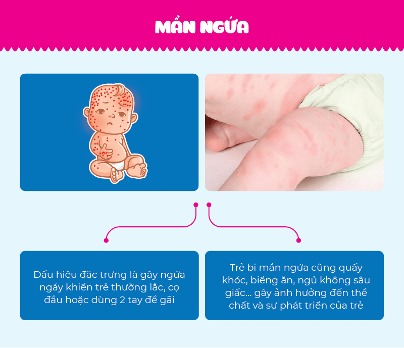 mẩn ngứa
