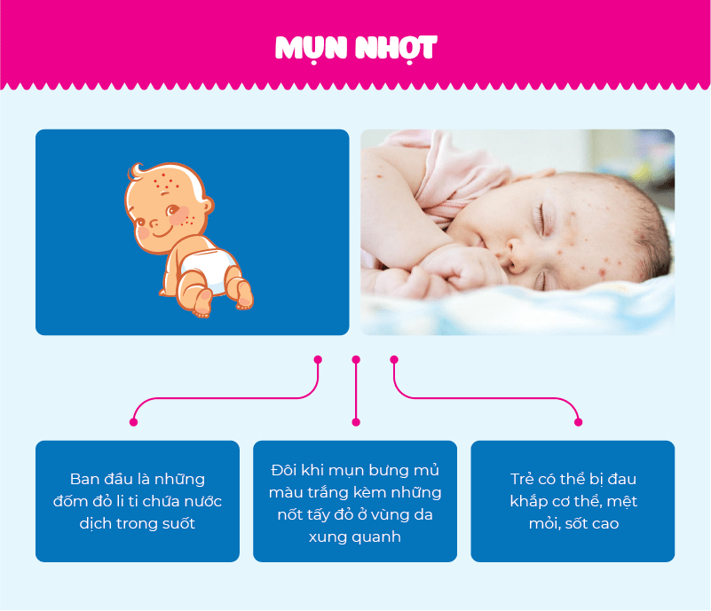 Bệnh mụn nhọt thường xuất hiện vào mùa hè