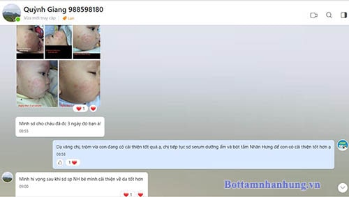 Thường xuyên liên hệ với dược sĩ nhãn hàng để đạt hiệu quả cao nhất trong quá trình sử dụng bộ đôi chàm sữa Nhân Hưng