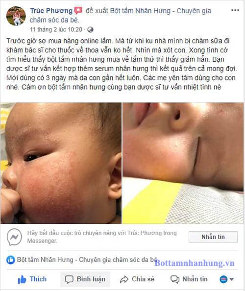 Từng rất sợ mua hàng online, nhưng đến khi con bị chàm sữa dùng thuốc của bác sĩ không hết, mẹ Trúc Phương tìm đến bộ đôi chàm sữa Nhân Hưng. Kết quả hơn cả mong đợi khi dùng 3 ngày da con đã gần như khỏi hoàn toàn