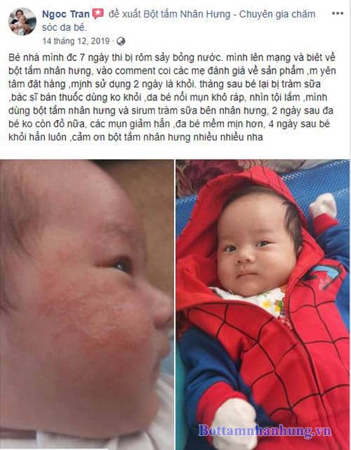 Các mẹ có tin được không, chỉ 4 ngày dùng bộ đôi chàm sữa Nhân Hưng bé nhà mẹ Ngoc Tran đã khỏi hẳn chàm sữa, mặc dù trước đó đã dùng thuốc của bác sĩ kê nhưng không hết