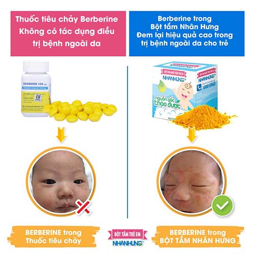 Bà nói tôi “giết thằng bé” khi dùng thuốc tiêu chảy béc be rin để trị chàm sữa