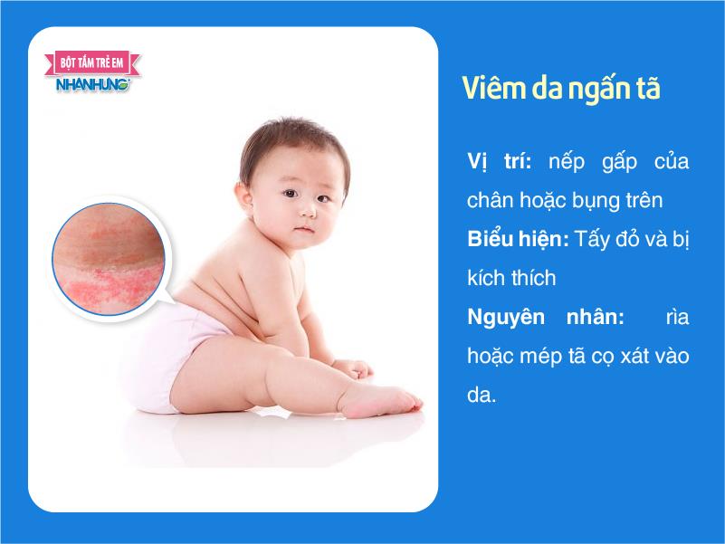 Viêm da ngấn tã