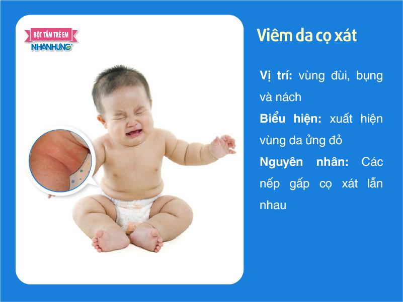 Viêm da cọ xát