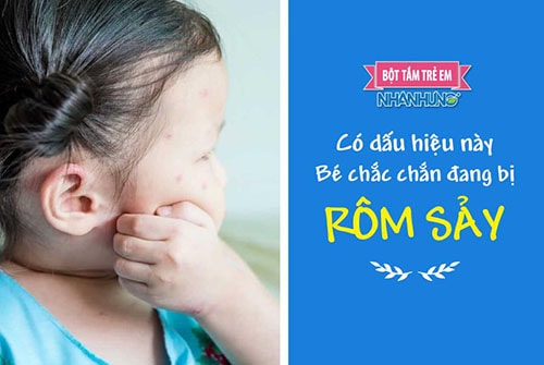 Mùa hè nóng nực khiến nhiều trẻ bị nổi rôm sảy.