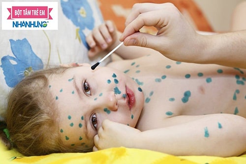  Trẻ em là đối tượng bị bệnh phỏng dạ cao nhất