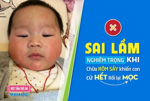 Sai lầm nghiêm trọng khi chữa rôm sảy khiến con cứ hết rồi lại mọc