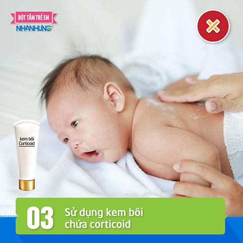 Sử dụng kem bôi chứa corticoid nguy hại cho da bé.