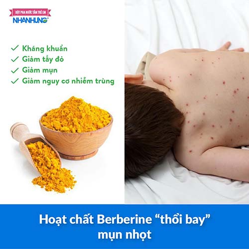 Hoạt chất Berberine “thổi bay” mụn nhọt