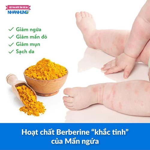 Hoạt chất Berberine “khắc tinh” của Mẩn ngứa