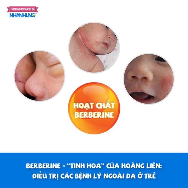 Berberine - “tinh hoa” của Hoàng liên: điều trị các bệnh lý ngoài da ở trẻ.